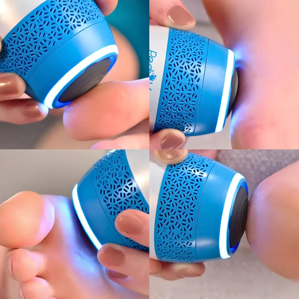 ELECTRIC FOOT CALLUS REMOVER