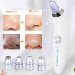 3 in 1 Derma Suction Cell Operated