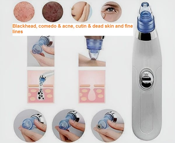 3 in 1 Derma Suction