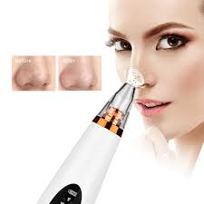 3 in 1 Black Head Remover